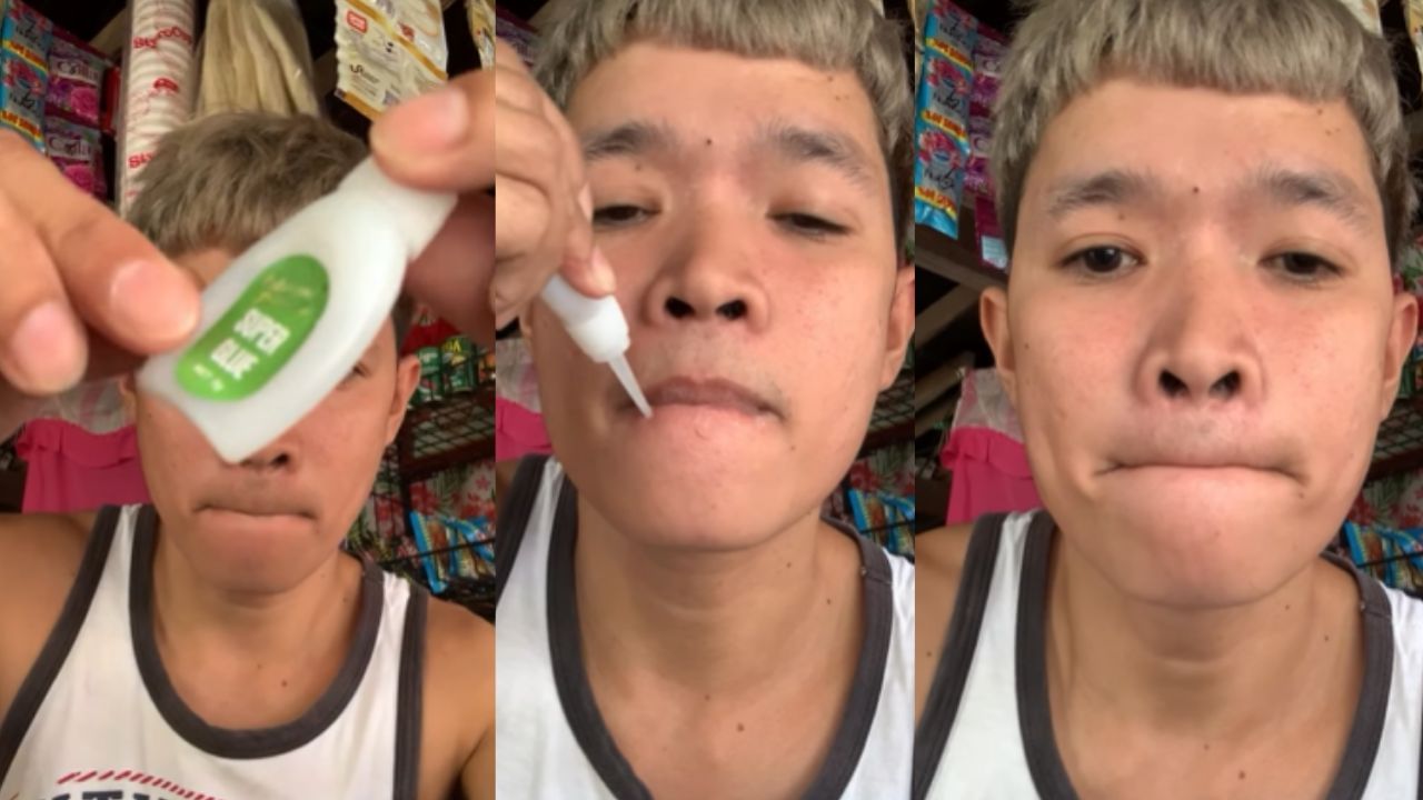 Viral Video: பசையுடன் விளையாடிய நபர்.. ஒட்டிக்கொண்ட உதடுகள்!
