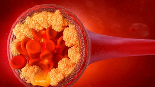 Mother’s Day : அம்மாவுக்கு இதய நோய்கள் வராமல் தடுக்க 5 வழிகள்!