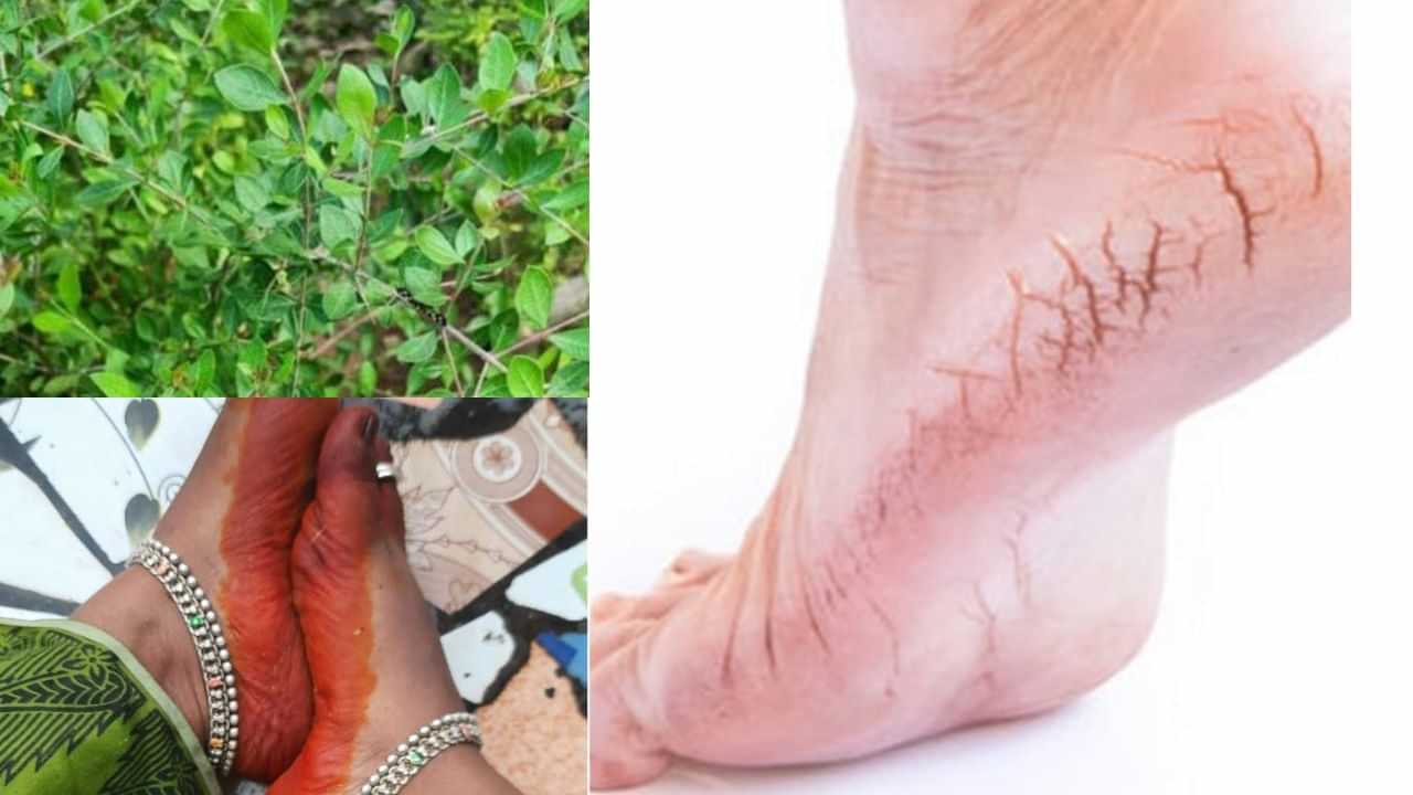 மருதாணி: வெடிப்புற்ற குதிகாலை சரியாக்குமா? மருத்துவரின் ஆலோசனை இதோ!