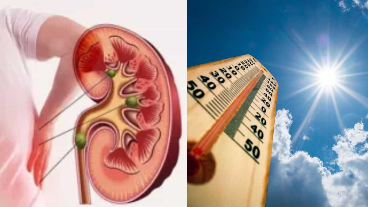 கோடை காலத்தில் சிறுநீரக கல் உருவாகும் அபாயம் அதிகரிக்குமா?