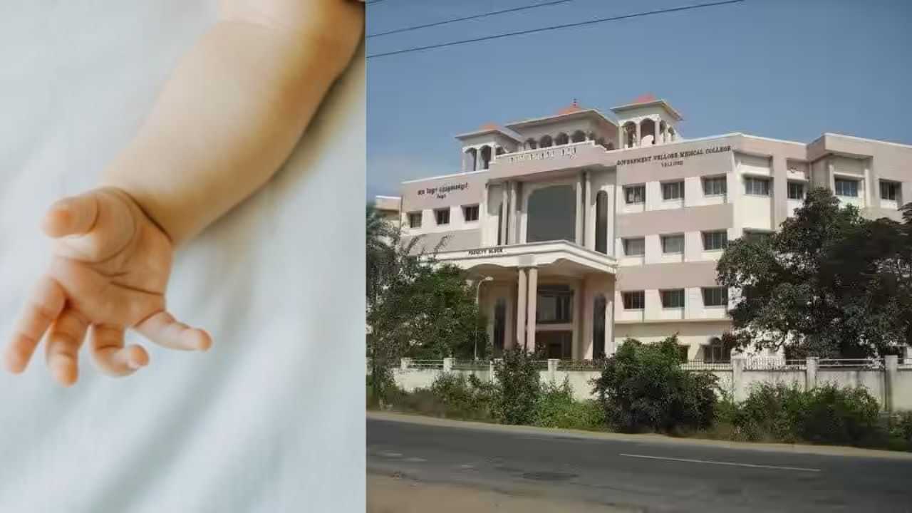 வேலூர் அரசு மருத்துவமனையில் பச்சிளம் குழந்தையின் விரலை துண்டித்த செவிலியர்...