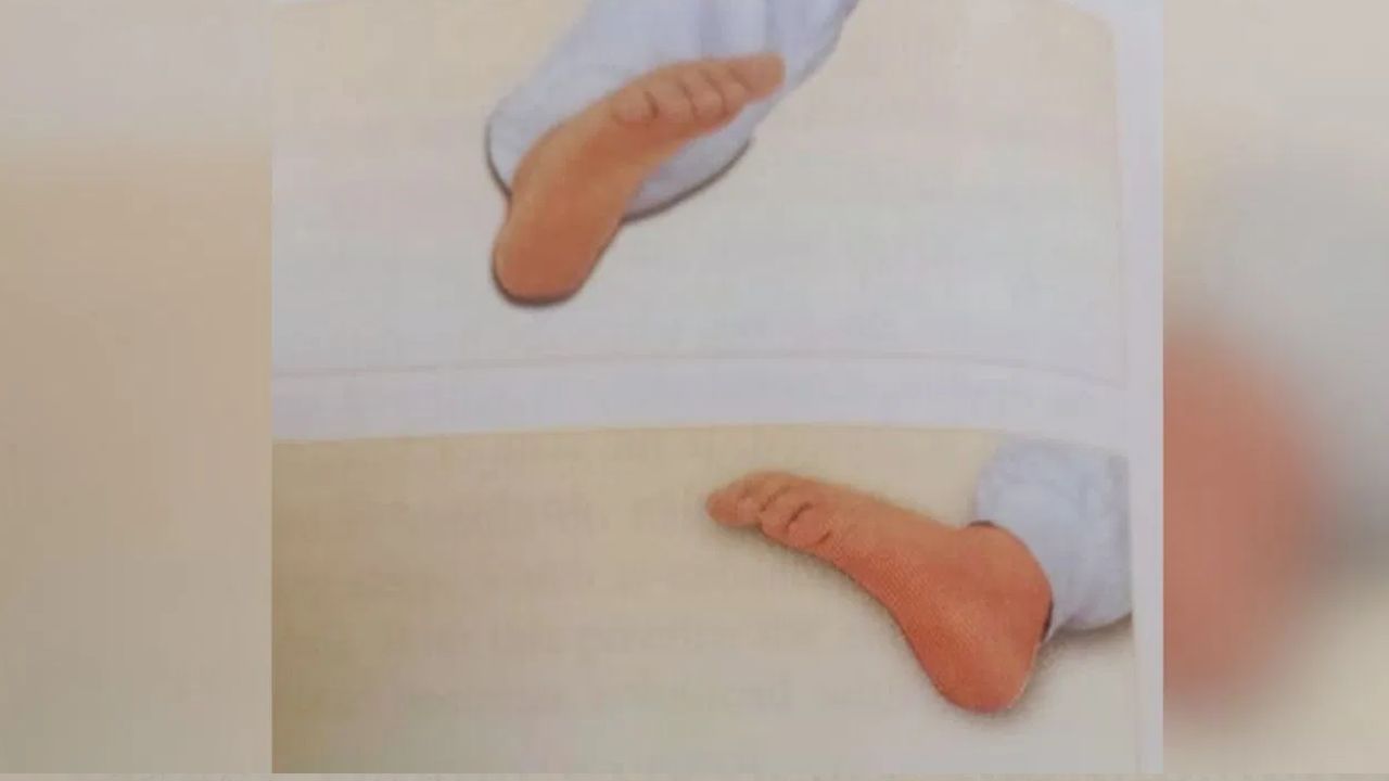 Exercise For Pain