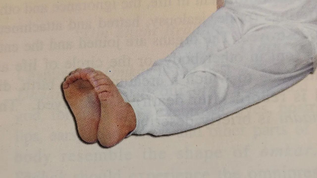 Exercise For Pain Relief