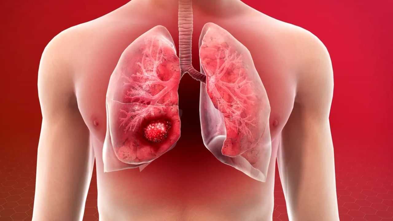 நுரையீரல் சளியை ஈசியா வெளியேற்றலாம்.. வீட்டில் இருக்கும் மருத்துவம்!