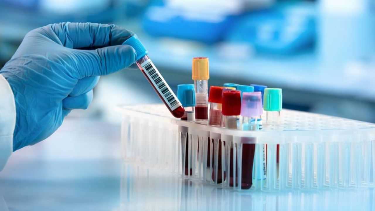 உலகிலேயே யாருக்கும் இல்லாத அரிய வகை ரத்தம் கண்டுபிடிப்பு.. ஷாக் கொடுத்த கர்நாடகா பெண்!