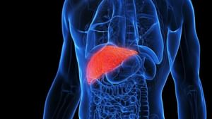 Liver Health Tips : மது அருந்தாதவர்களுக்கும் வரும் கல்லீரல் சிக்கல்.. 3 முக்கிய காரணங்கள் இவைதான்!