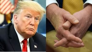 Donald Trump : அமெரிக்க அதிபர் டொனால்ட் டிரம்புக்கு நரம்பு நோய்..விளக்கம் அளித்த வெள்ளை மாளிகை!