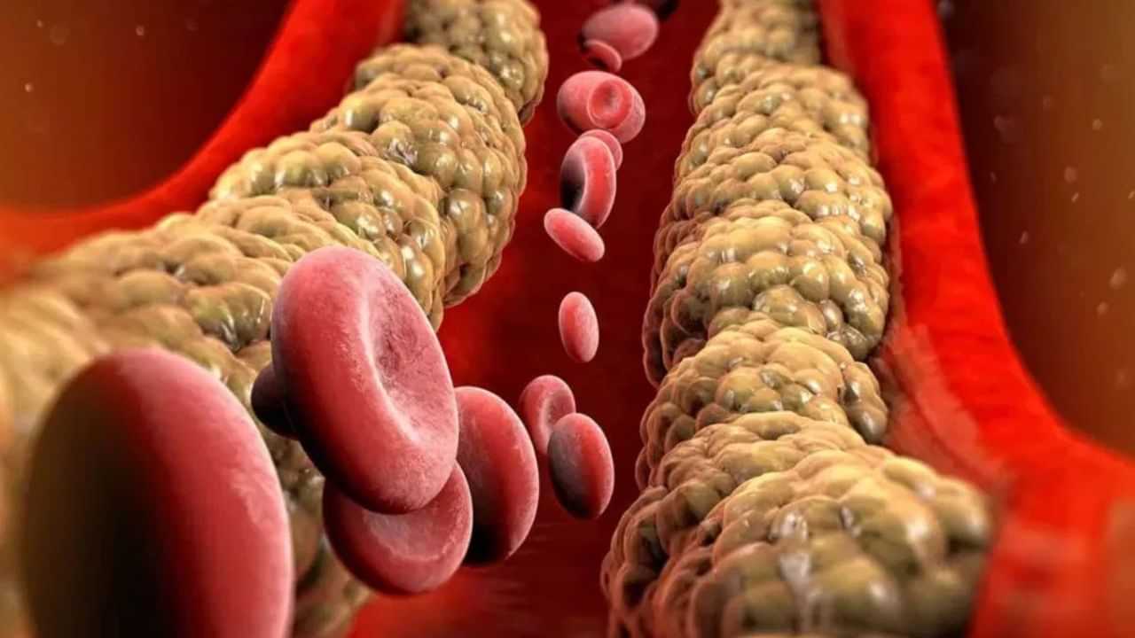 High Cholesterol Risk: குடும்பத்தில் கொலஸ்ட்ரால் பிரச்சனையா? ஆரம்பக்கட்ட பரிசோதனை ஏன் முக்கியம்..?