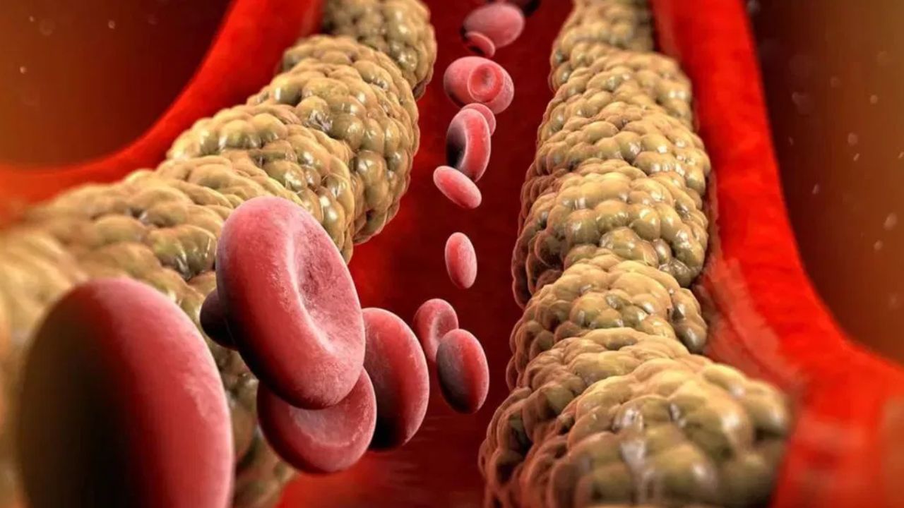 High Cholesterol Risk: குடும்பத்தில் கொலஸ்ட்ரால் பிரச்சனையா? ஆரம்பக்கட்ட பரிசோதனை ஏன் முக்கியம்..? High Cholesterol Risk: குடும்பத்தில் கொலஸ்ட்ரால் பிரச்சனையா? ஆரம்பக்கட்ட பரிசோதனை ஏன் முக்கியம்..?
