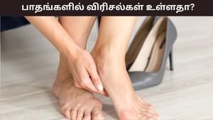 Cracked Heels: மழைக்காலத்தில் கால் பாதத்தில் வெடிப்புடன் வலியா..? இந்த பொருட்கள் எளிதில் குணமாக்கும்!
