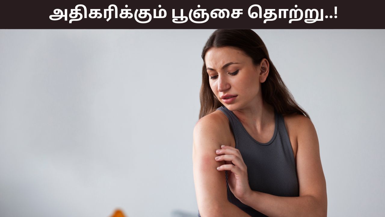 Health Tips: மழைக்காலத்தில் பூஞ்சை தொற்று ஏன் தோன்றுகின்றன..? காரணங்களும், தீர்வுகளும்..! Health Tips: மழைக்காலத்தில் பூஞ்சை தொற்று ஏன் தோன்றுகின்றன..? காரணங்களும், தீர்வுகளும்..!