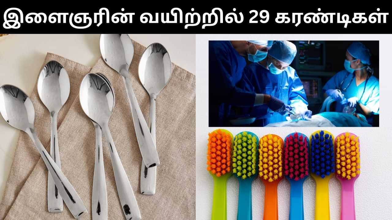இளைஞர் வயிற்றில் 29 கரண்டிகள், 19 பிரஷ்கள்.. மருத்துவர்களையே அதிர்ச்சிக்கு உள்ளாக்கிய பகீர் சம்பவம்!