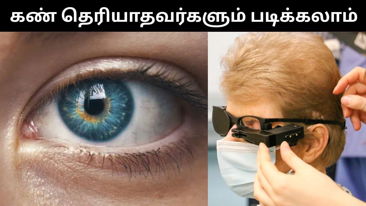 ஒரே ஒரு சிப் போதும்.. இனி கண் தெரியாதவர்களும் படிக்கலாம்.. வியக்க வைக்கும் விஞ்ஞானம்! ஒரே ஒரு சிப் போதும்.. இனி கண் தெரியாதவர்களும் படிக்கலாம்.. வியக்க வைக்கும் விஞ்ஞானம்!