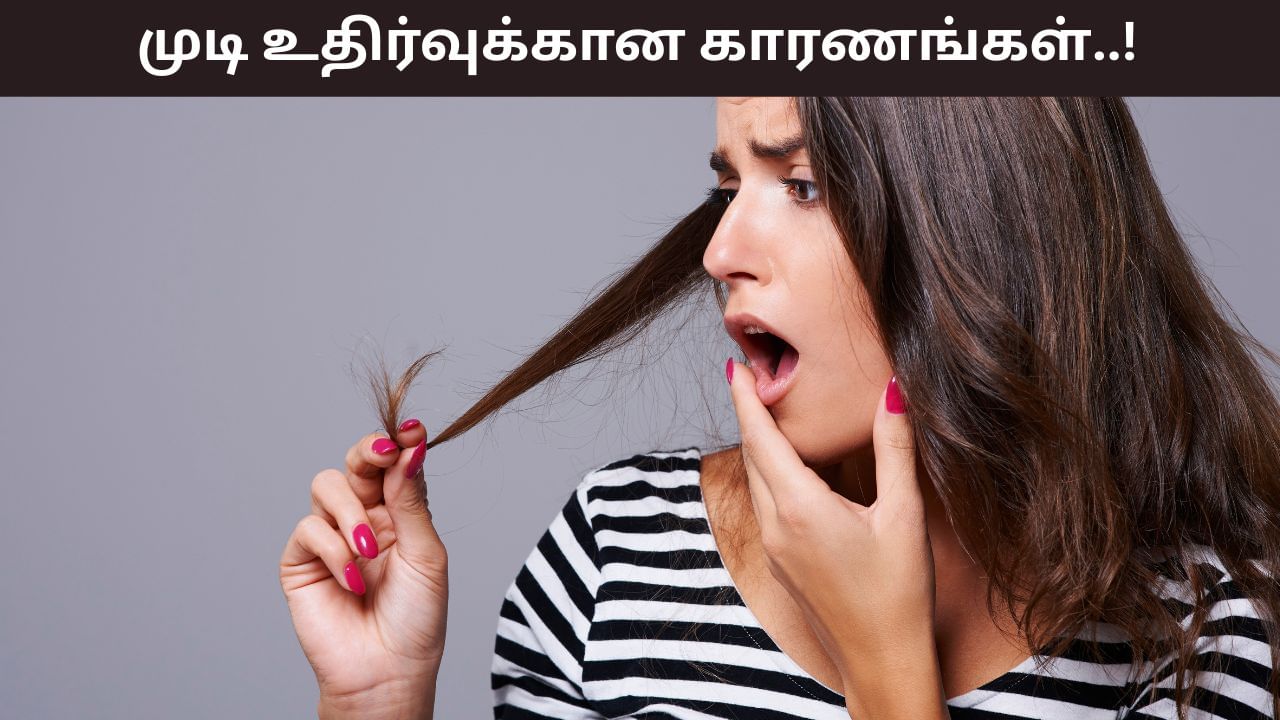 Hair Fall: முடி உதிர்தலுக்கான காரணம் புரியவில்லையா? இந்த 5 உணவுகள் சேதப்படுத்தும்..! Hair Fall: முடி உதிர்தலுக்கான காரணம் புரியவில்லையா? இந்த 5 உணவுகள் சேதப்படுத்தும்..!