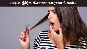 Hair Fall: முடி உதிர்தலுக்கான காரணம் புரியவில்லையா? இந்த 5 உணவுகள் சேதப்படுத்தும்..! Hair Fall: முடி உதிர்தலுக்கான காரணம் புரியவில்லையா? இந்த 5 உணவுகள் சேதப்படுத்தும்..!