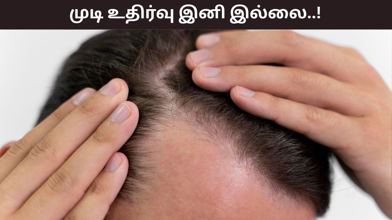 Hair Care Tips: எது செய்தாலும் முடி உதிர்தல் இன்னும் நிற்கவில்லையா? இந்த வீட்டு வைத்தியங்கள் உதவும்..! Hair Care Tips: எது செய்தாலும் முடி உதிர்தல் இன்னும் நிற்கவில்லையா? இந்த வீட்டு வைத்தியங்கள் உதவும்..!