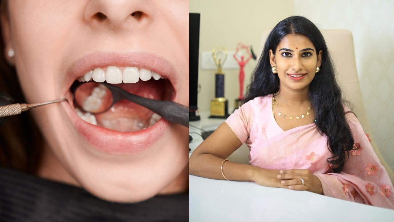 Teeth Cavities: பல் சொத்தை ஏற்படுவதற்குக் காரணம் என்ன..? பல் மருத்துவர் ஜனனி ஜெயபால் விளக்கம்! Teeth Cavities: பல் சொத்தை ஏற்படுவதற்குக் காரணம் என்ன..? பல் மருத்துவர் ஜனனி ஜெயபால் விளக்கம்!