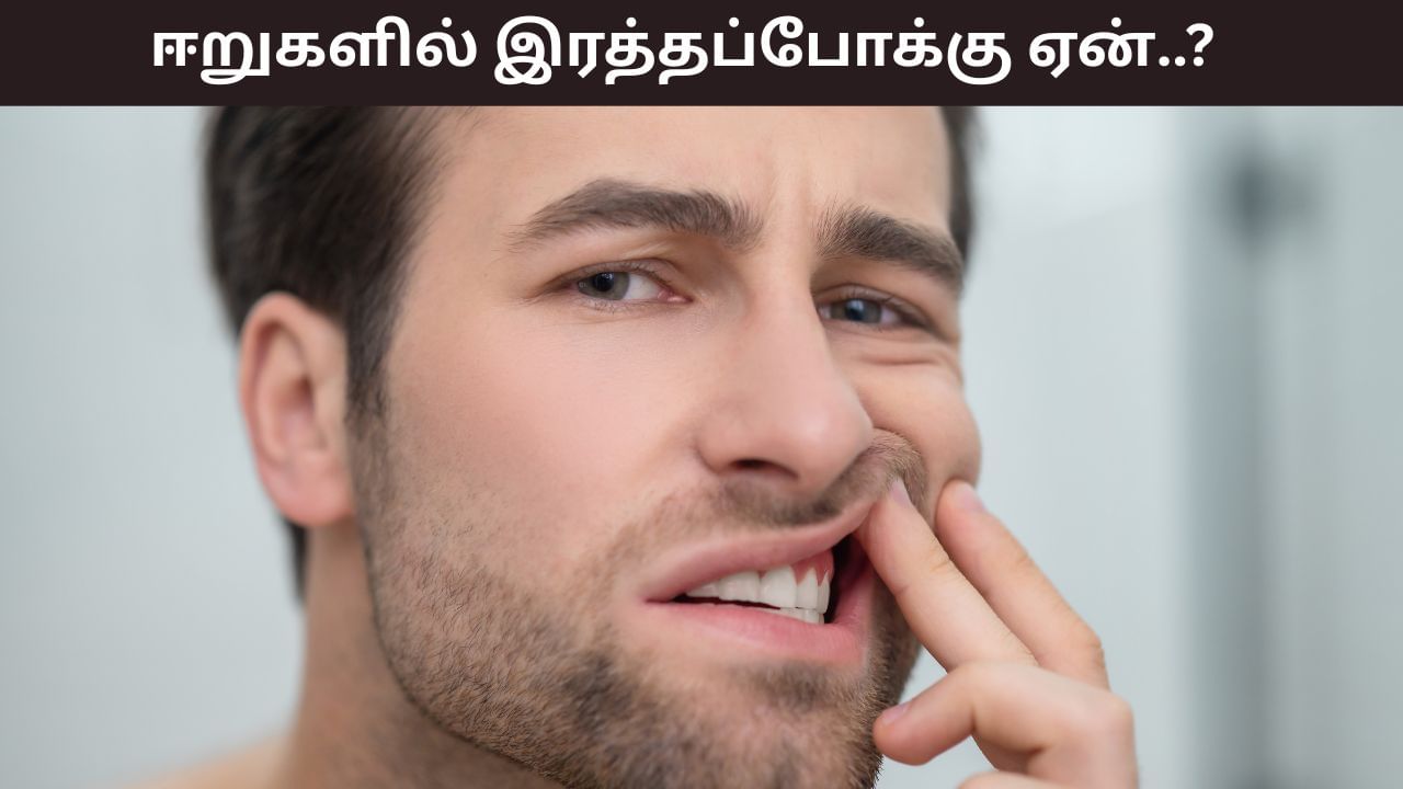 Bleeding Gum: ஈறுகளில் இரத்தப்போக்கு பிரச்சனையா? இது எதனால் ஏற்படுகிறது..?