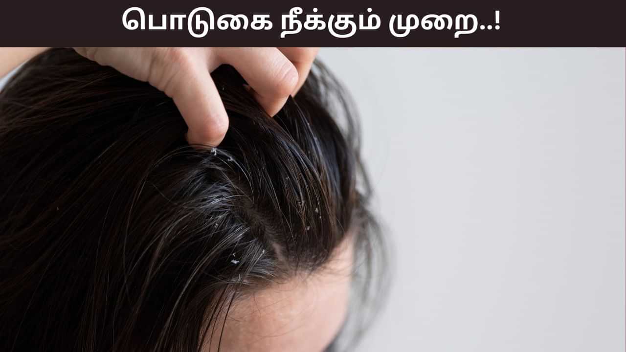 Hair Care: ஜில் கிளைமேட் வந்தவுடன் தலையில் பொடுகு தொல்லையா..? இதை செய்தால் உடனடியாக நீங்கும்! Hair Care: ஜில் கிளைமேட் வந்தவுடன் தலையில் பொடுகு தொல்லையா..? இதை செய்தால் உடனடியாக நீங்கும்!