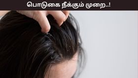 Hair Care: ஜில் கிளைமேட் வந்தவுடன் தலையில் பொடுகு தொல்லையா..? இதை செய்தால் உடனடியாக நீங்கும்!...