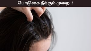 Hair Care: ஜில் கிளைமேட் வந்தவுடன் தலையில் பொடுகு தொல்லையா..? இதை செய்தால் உடனடியாக நீங்கும்!