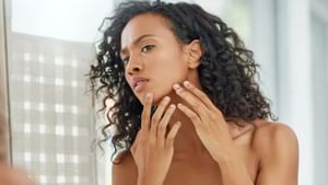 Beauty Tips: எந்த வைட்டமின் குறைபாட்டால் சருமம் கருமையாகிறது..? இதனை சரிசெய்வது எப்படி?