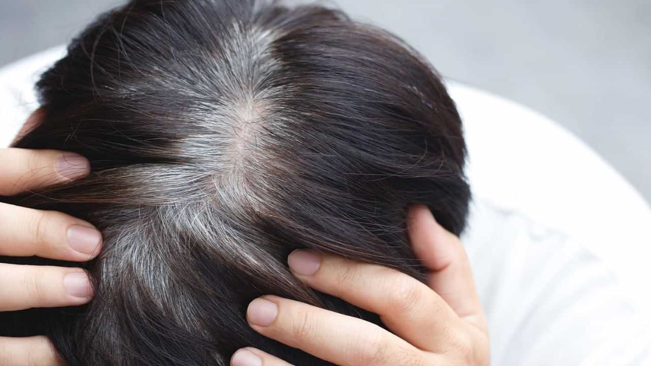 Hair Care: சிறு வயதிலேயே நரை முடி தொல்லையா..? இந்த வைட்டமின் குறைபாடு காரணம்! Hair Care: சிறு வயதிலேயே நரை முடி தொல்லையா..? இந்த வைட்டமின் குறைபாடு காரணம்!