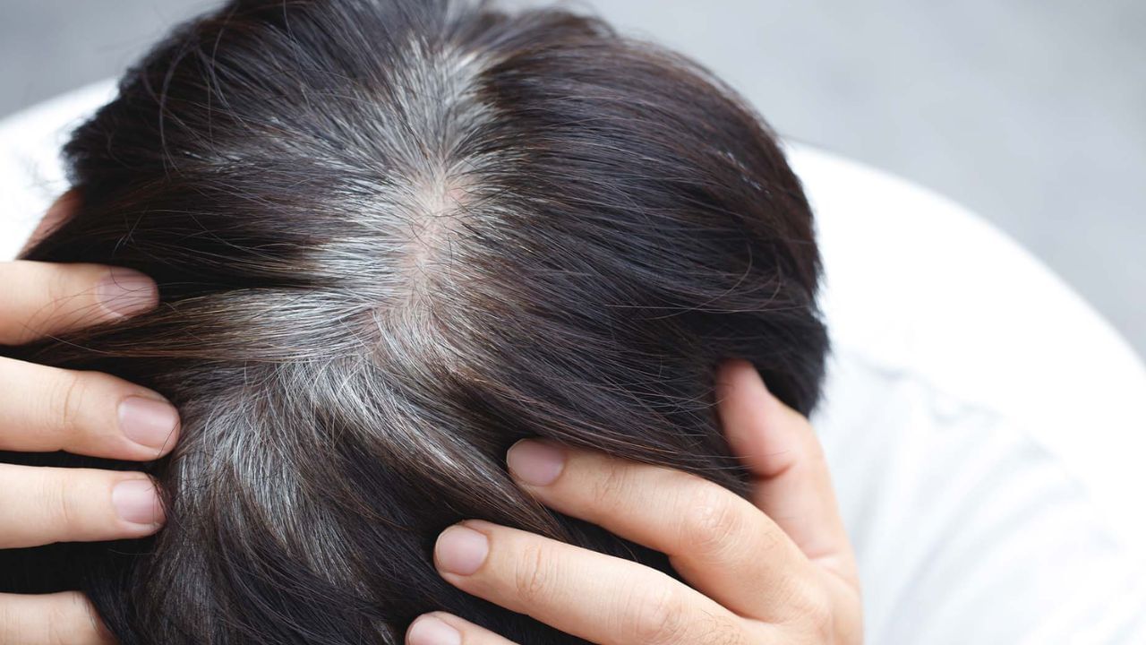 Hair Care: சிறு வயதிலேயே நரை முடி தொல்லையா..? இந்த வைட்டமின் குறைபாடு காரணம்!