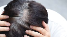 Hair Care: சிறு வயதிலேயே நரை முடி தொல்லையா..? இந்த வைட்டமின் குறைபாடு காரணம்!...