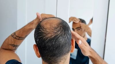 முடி சரசரனு கொட்டுதா? இந்த விஷயத்தை கவனிக்க மறக்காதீங்க!