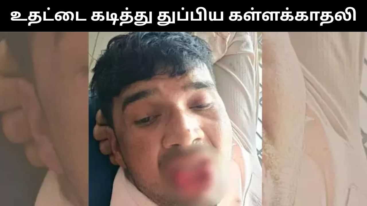 முத்தம் கொடுக்க வந்த கள்ளக்காதலனின் உதட்டை கடித்து துப்பிய காதலி.. ஷாக் சம்பவம்! முத்தம் கொடுக்க வந்த கள்ளக்காதலனின் உதட்டை கடித்து துப்பிய காதலி.. ஷாக் சம்பவம்!