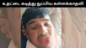 முத்தம் கொடுக்க வந்த கள்ளக்காதலனின் உதட்டை கடித்து துப்பிய காதலி.. ஷாக் சம்பவம்!...