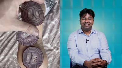 காலில் வெங்காயம் வைத்தால் காய்ச்சல் குணமாகுமா? Dr சரவணன் விளக்கம்