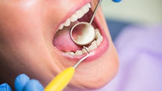 Teeth Care: இனிப்பு சாப்பிட்டாலே சொத்தை பல் பயமா..? இதை செய்தால் வராது!