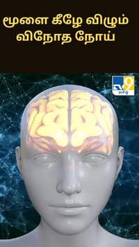 மூளை கீழே விழும் விநோத நோய் - 14 ஆண்டுகளாக போராடும் ஆசிரியர்...