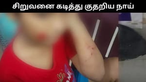 டியூஷனுக்கு சென்ற 8 வயது சிறுவனை கடித்து குதறிய தெரு நாய்.. அதிர்ச்சி சம்பவம்! டியூஷனுக்கு சென்ற 8 வயது சிறுவனை கடித்து குதறிய தெரு நாய்.. அதிர்ச்சி சம்பவம்!