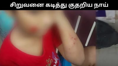 டியூஷனுக்கு சென்ற 8 வயது சிறுவனை கடித்து குதறிய தெரு நாய்!