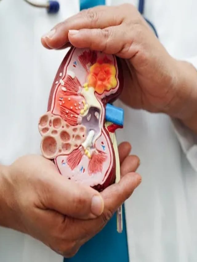 சிறுநீரகங்கள் பாதிக்கப்பட்டால் உடலில் ஏற்படும் அறிகுறிகள்..!