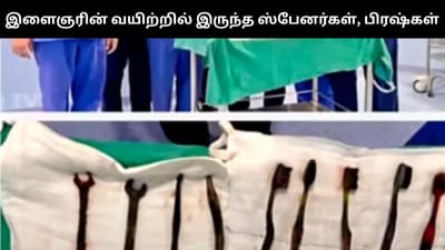இளைஞரின் வயிற்றுக்குள் இரும்பு ஸ்பேனர்கள், டூத் பிரஷ்கள் - ஷாக்!
