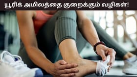 Health Tips: யூரிக் அமிலம் உடலில் கட்டுப்பாட்டில் இல்லையா? இந்த 3 பழங்கள் சட்டென குறைக்கும்!...