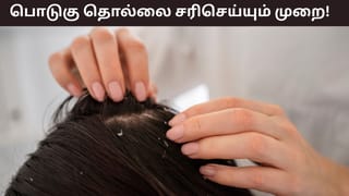 Dandruff Problems: பொடுகு தொல்லையா..? எண்ணெய் தேய்த்தும் பலன் இல்லையா? சில டிப்ஸ் இதோ!