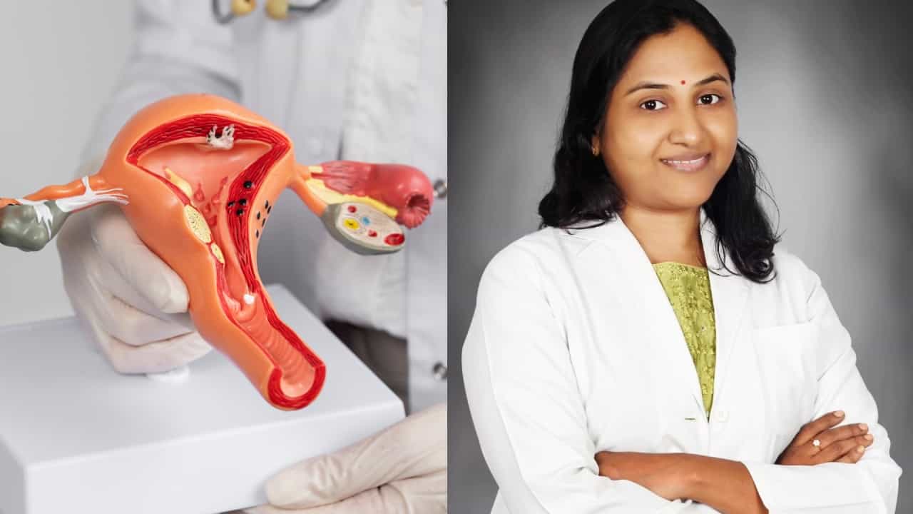 Health Tips: பெண்களுக்கு கர்ப்பப்பை வாய்ப் புற்றுநோய் பயமா? மருத்துவர் அஸ்மி சவுந்தர்யா விளக்கம்! Health Tips: பெண்களுக்கு கர்ப்பப்பை வாய்ப் புற்றுநோய் பயமா? மருத்துவர் அஸ்மி சவுந்தர்யா விளக்கம்!