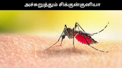 தமிழகத்தில் அதிகரிக்கும் சிக்குன்குனியா பாதிப்பு..