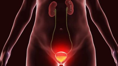 அடிக்கடி சிறுநீர் கழிக்க என்ன காரணம் தெரியுமா?