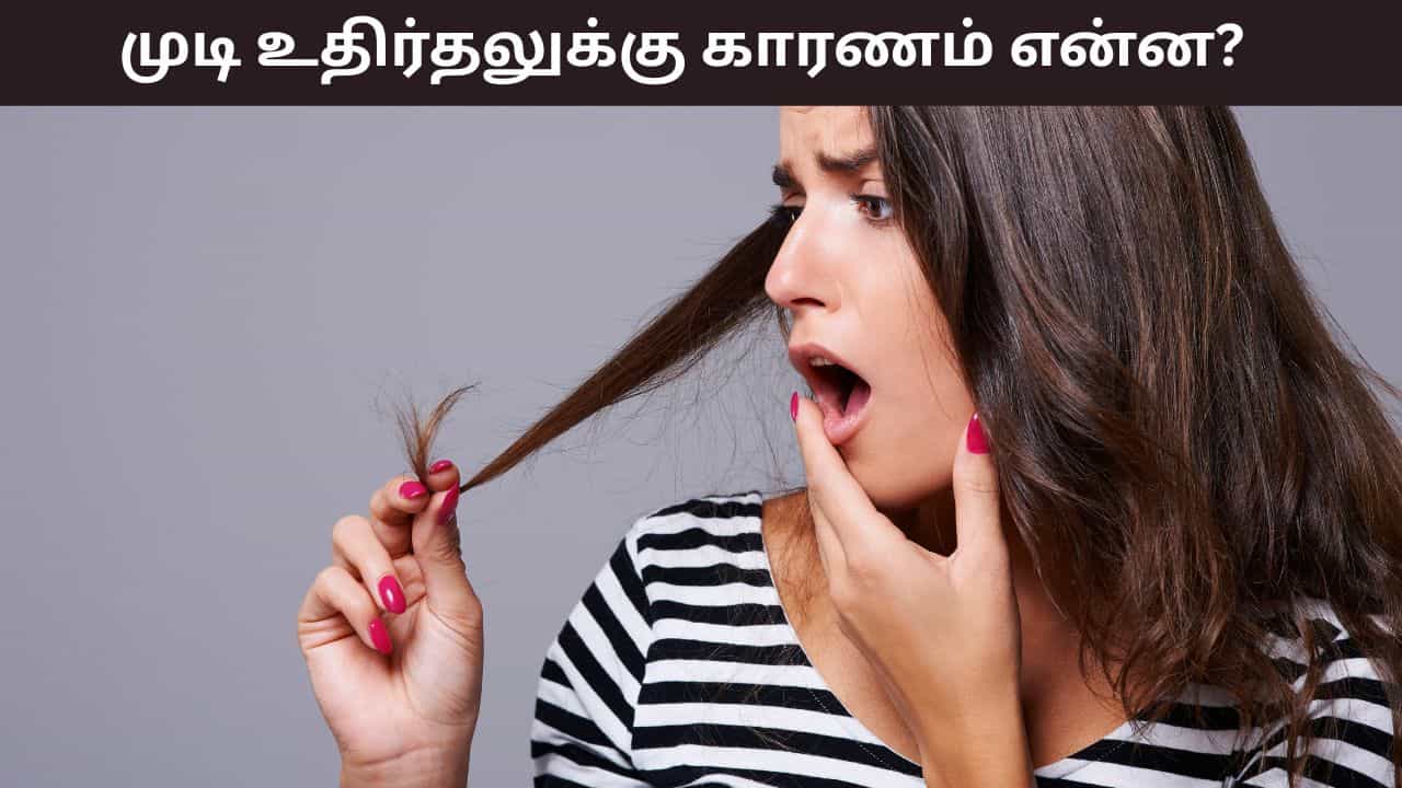 Hair Care: அதிகப்படியான முடி உதிர்தல் பிரச்சனையா..? இந்த ஊட்டச்சத்து குறைபாடே காரணம்!