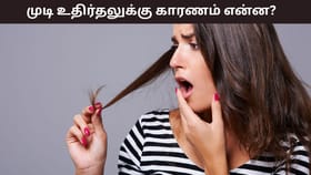 Hair Care: அதிகப்படியான முடி உதிர்தல் பிரச்சனையா..? இந்த ஊட்டச்சத்து குறைபாடே காரணம்!...