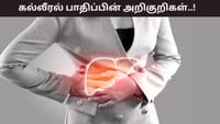 இரவில் இந்த 5 பிரச்சனைகளா..? கல்லீரல் பாதிப்பின் அறிகுறிகள்..!...