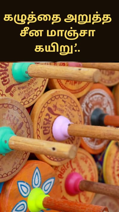 ‘கழுத்தை அறுத்த சீன மாஞ்சா கயிறு’.. உயிர்தப்பிய மதபோதகர்..