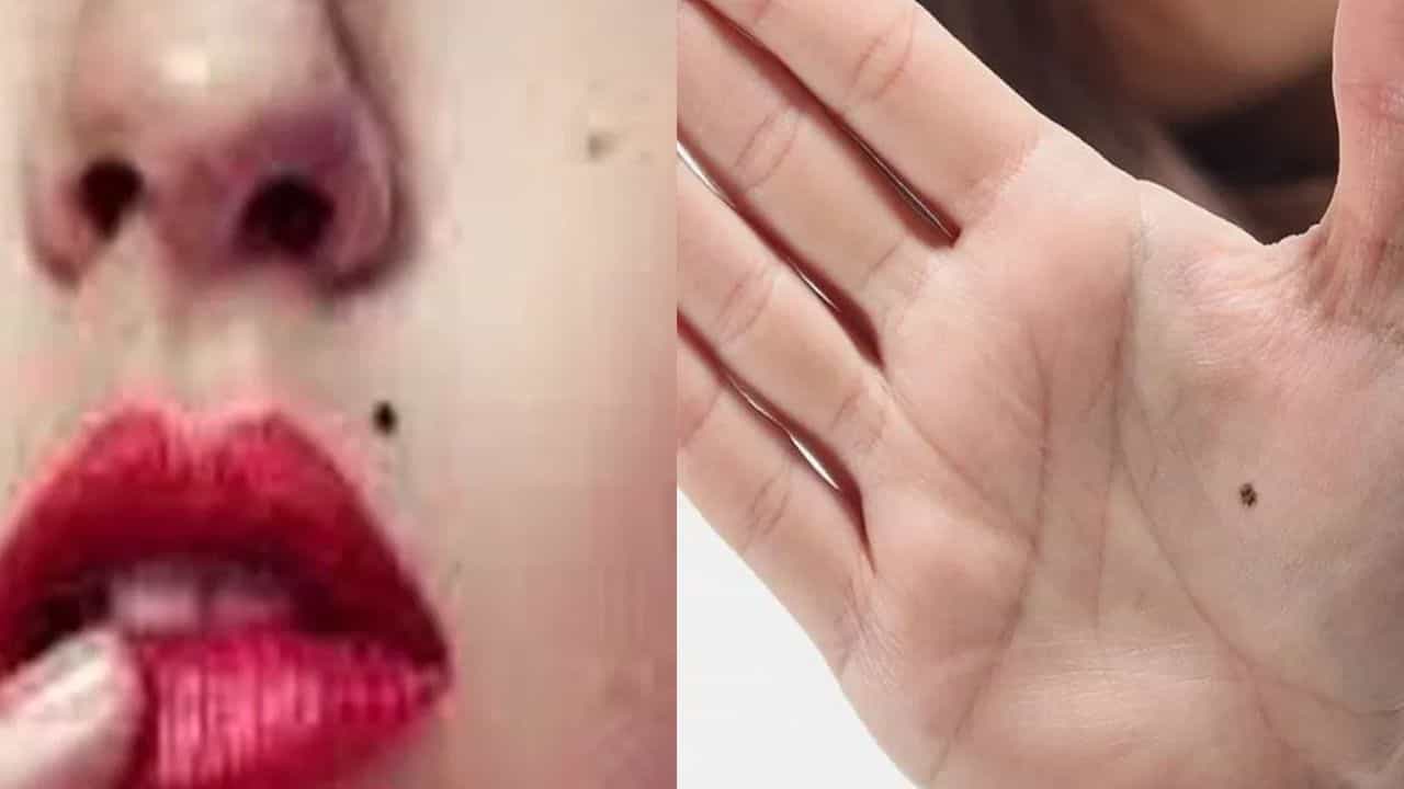 உடலில் மச்சங்கள் அர்த்தம் என்ன தெரியுமா? எங்கே இருந்தால் நல்லது?