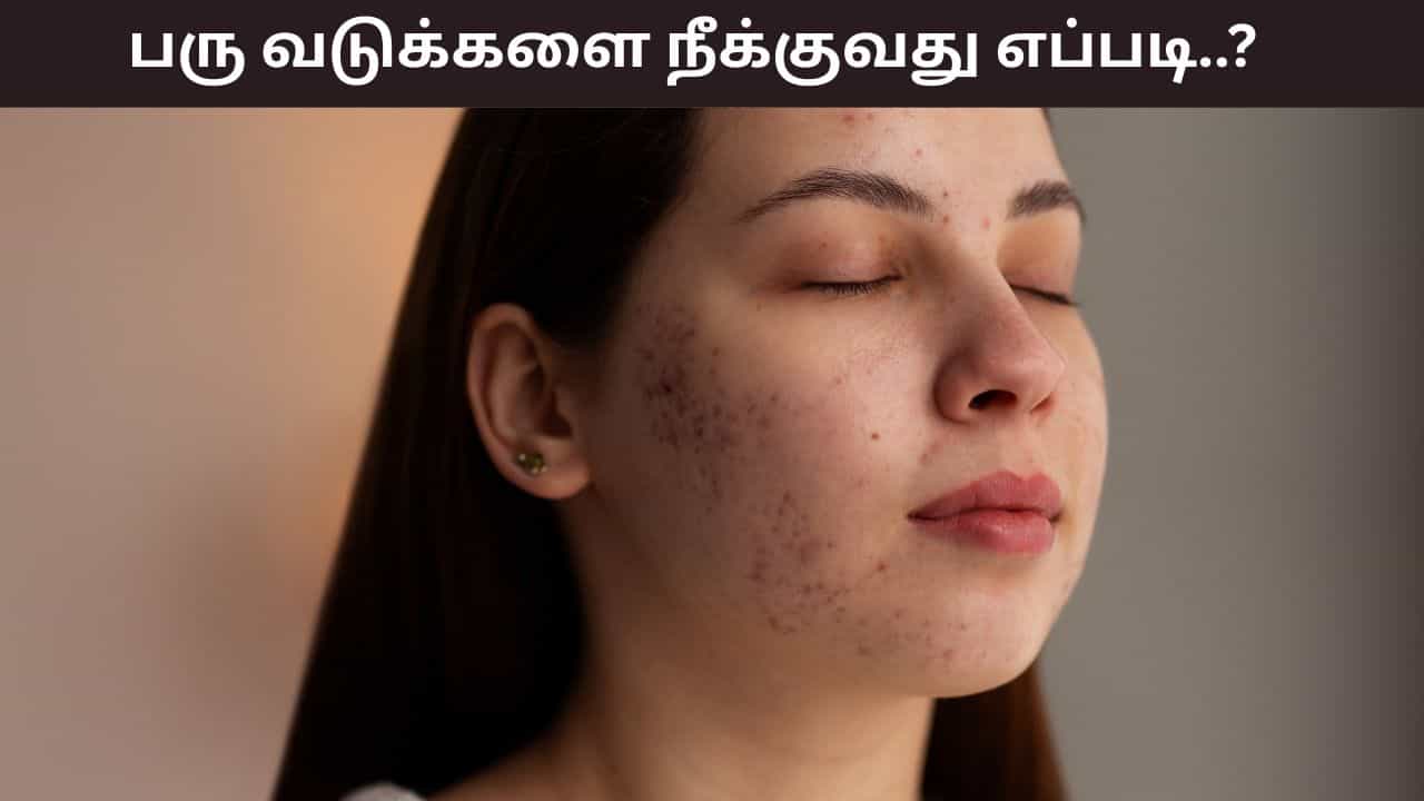 Skin Care: பருக்கள் வந்து முகத்தில் வடுக்களா..? சரிசெய்யும் 6 எளிய குறிப்புகள்..!